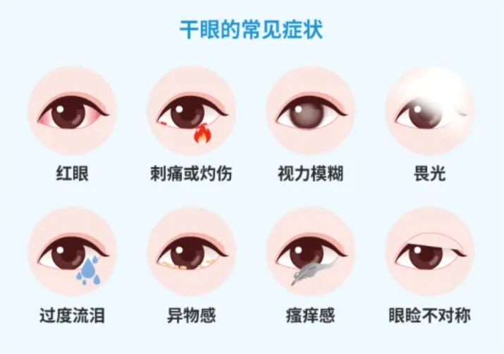 长期眼干眼涩、视疲劳怎么办？网红眼药水能用吗？